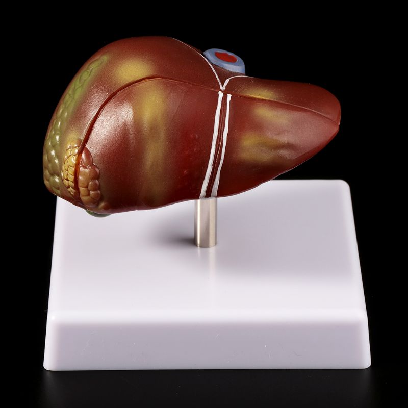 Wątroby ludzkiej patologicznyc – Medical Lab Technology recenzja i cena