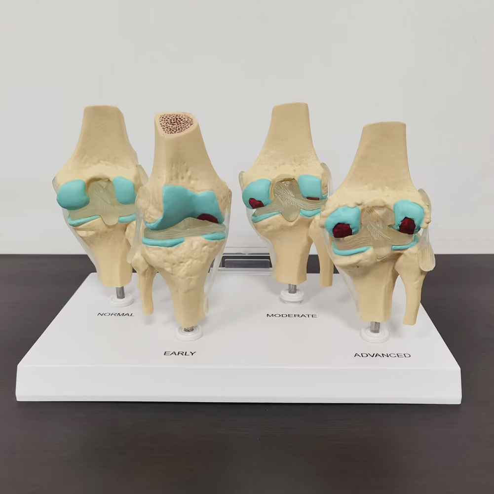 4-stopniowy model staw kolanow – Medical Lab Technology recenzja i cena